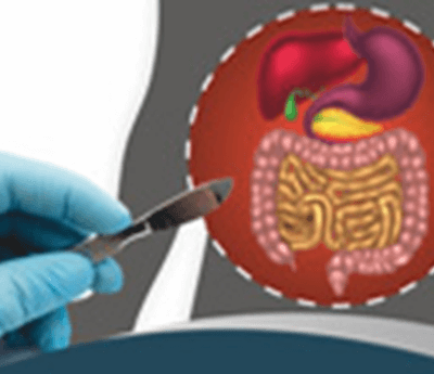 Gastro Intestinal Surgery