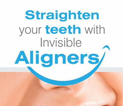Aligners