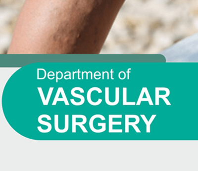 Varicose Vein