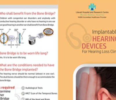Cochlear Implant