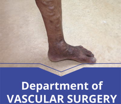 Department of Vascular Surgery