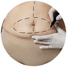 Bariatric Surgery